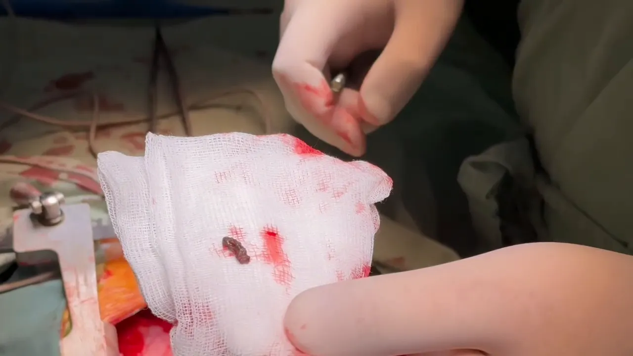 Потрапила під обстріл у Херсоні: із серця чотирирічної дівчинки дістали уламок російської міни. Відео