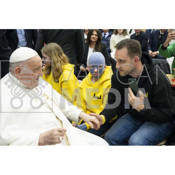 9-летний украинец, пострадавший от ракетного удара ВС РФ, встретился с Папой Римским