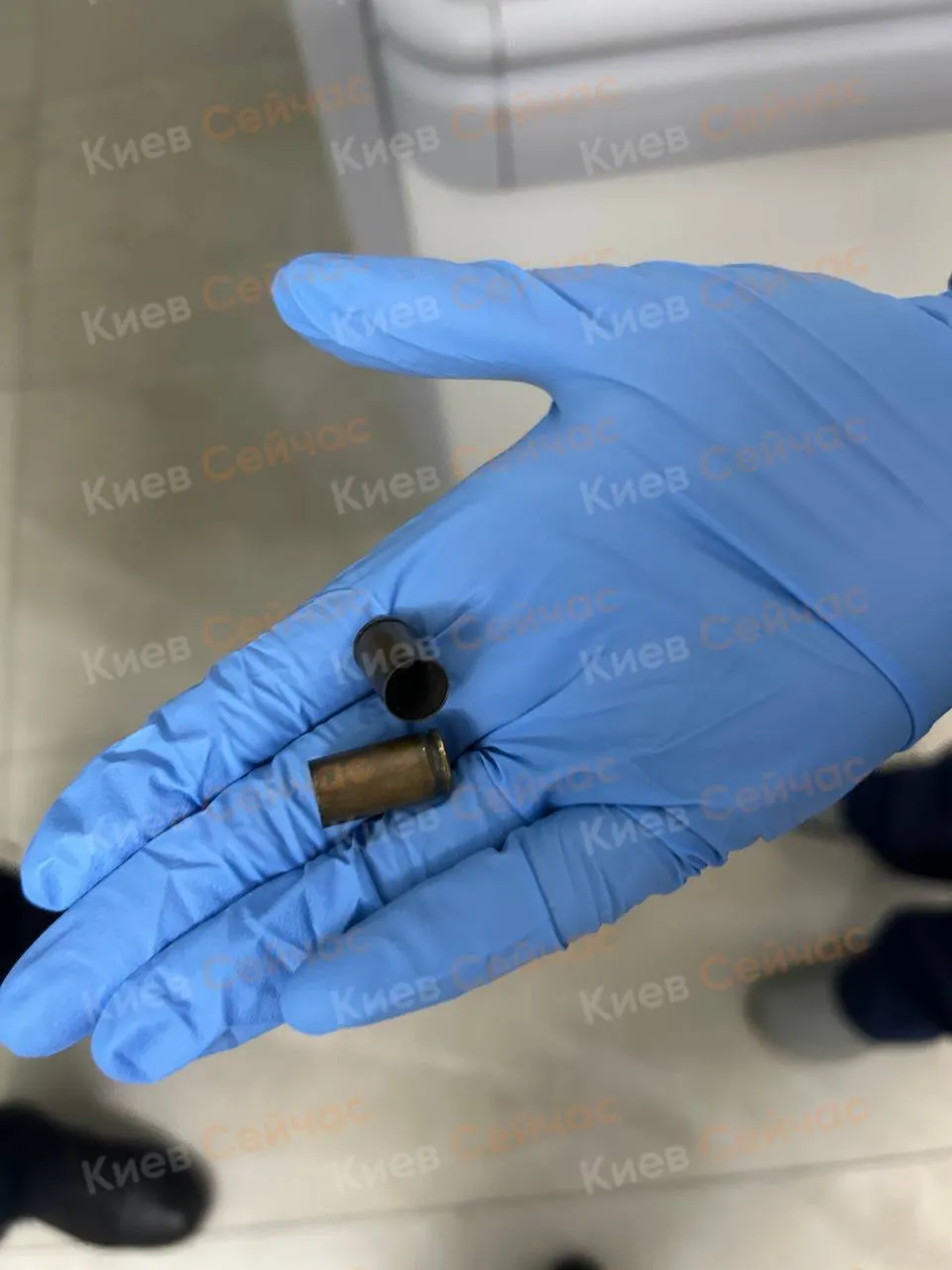 В Киеве на Осокорках мужчине во время прогулки прострелили ноги. Фото