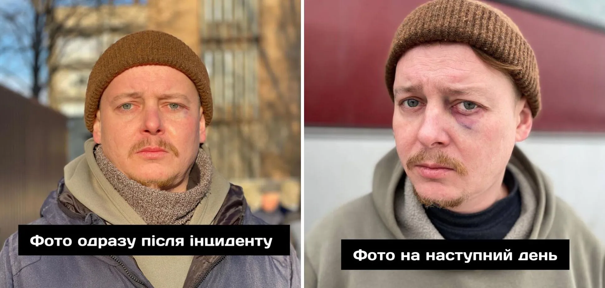      ,    dqxikeidqxitkant