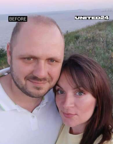 Как выглядит военный после 20 месяцев в русском плену. Эти фото должен увидеть весь мир dqxikeidqxiqqeant