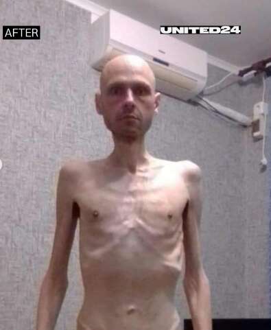 Как выглядит военный после 20 месяцев в русском плену. Эти фото должен увидеть весь мир