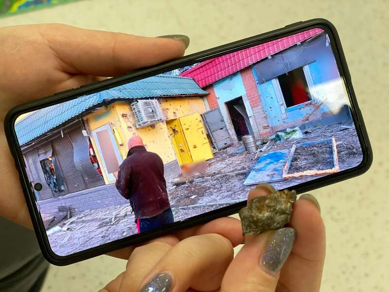 У Львові лікарі видалили уламок міни з мозку 9-річного хлопчика з Херсона: його друг під час обстрілу загинув на місці. Фото