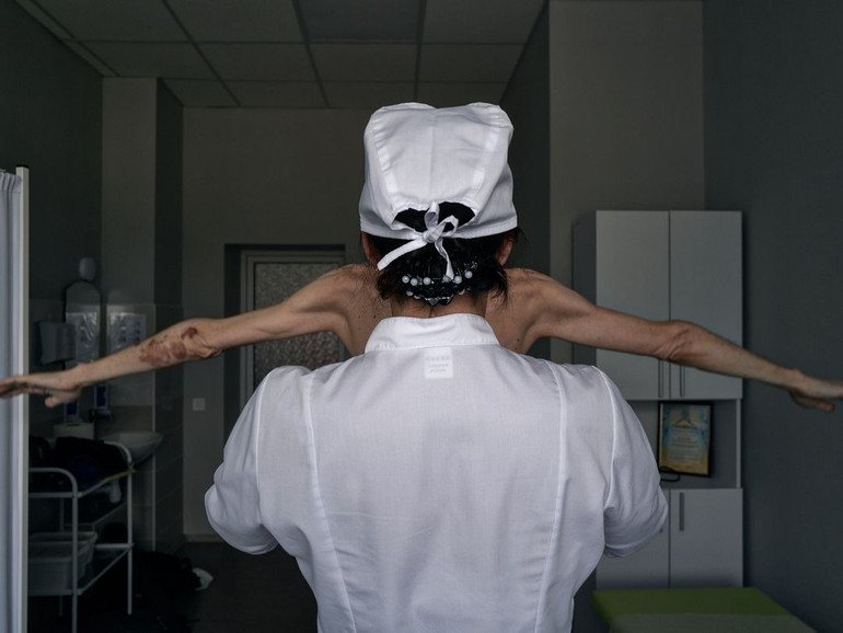 Photos of Ukrainians before and after Russian captivity