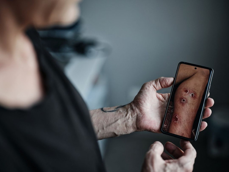 Exchange of prisoners on May 31: photos of freed soldiers