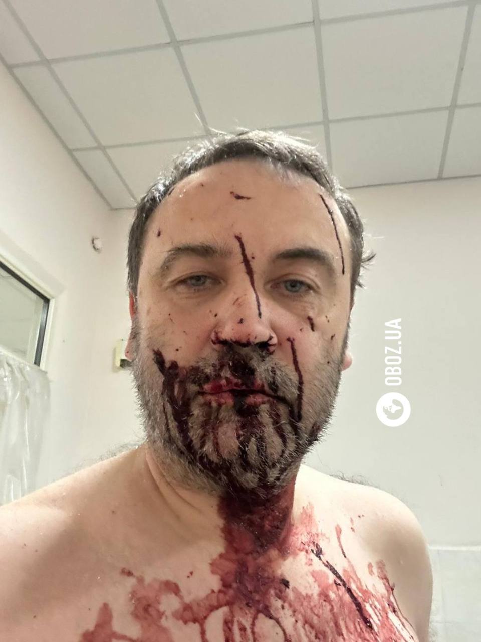A drone hit the house of Russian opposition leader Ponomarev near Kiev: the politician received numerous injuries. Photo