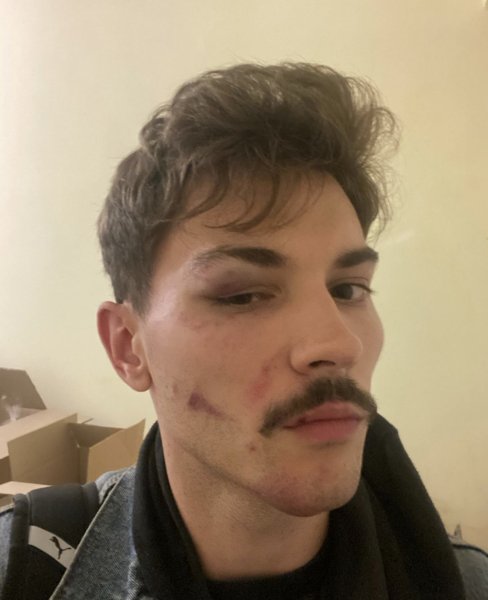  볺,  ,    dqxikeidqxitkant