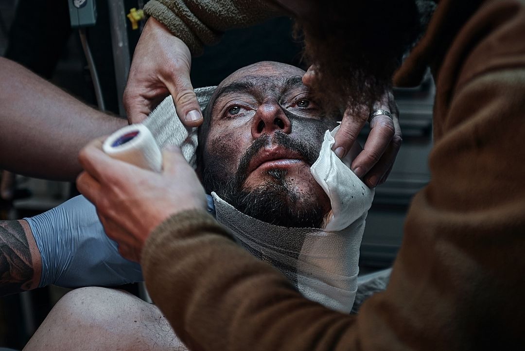 Пулевое ранение в голову, нет части челюсти: как медики спасают жизнь воинов на Кураховском направлении. Фото