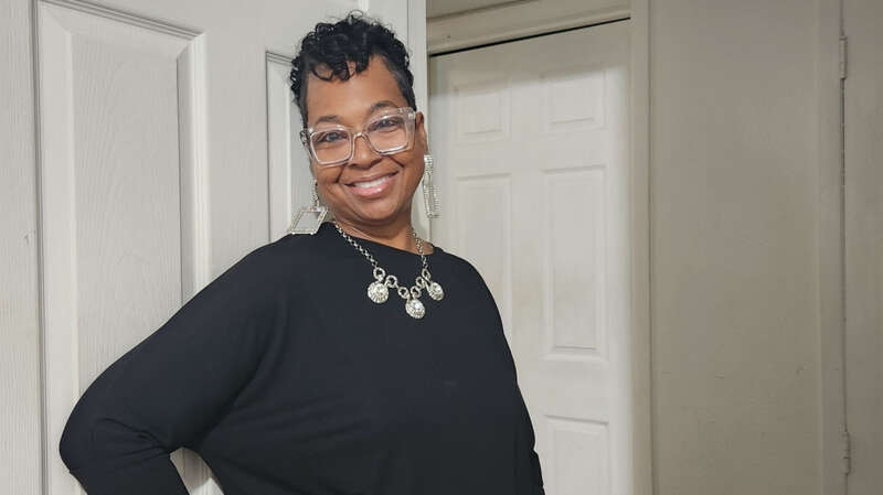 Тована Луни трансплантация почки, трансплантация, трансплантация органов, пересадка почки, пересадка органов, свиная почка, почка свиньи