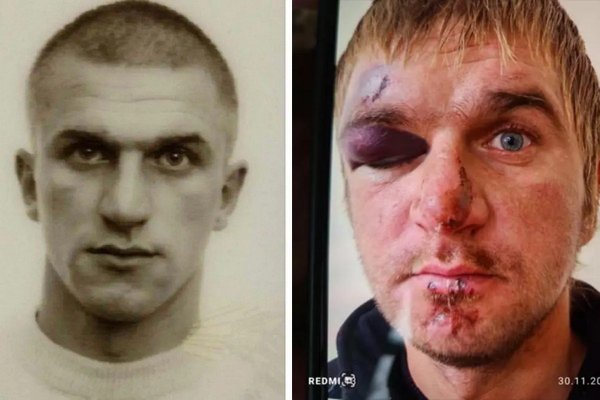 Зник після відвідин ТЦК: на Тернопільщині уже 4 місяці розшукують чоловіка (ФОТО) dqxikeidqxitkant