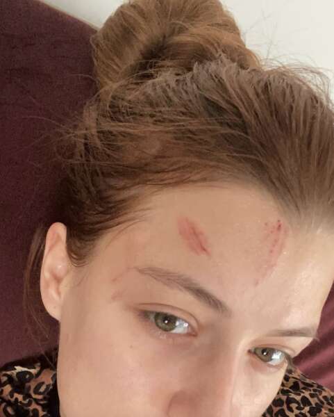 анастасія суббота синці dqxikeidqxitkant