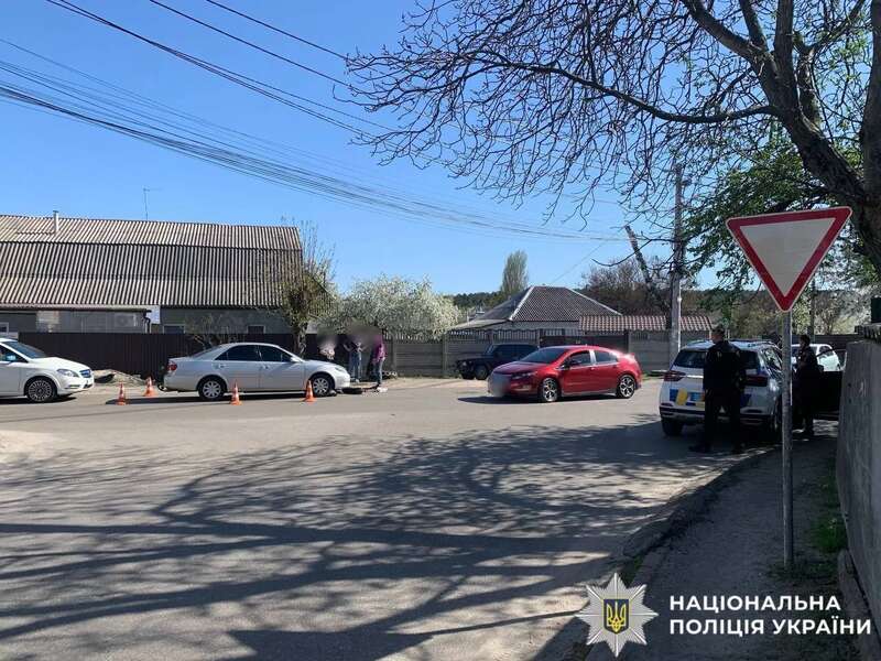 Под Киевом легковое авто сбило ребенка, который ехал на электросамокате. Подробности ДТП и фото dqxikeidqxitkant