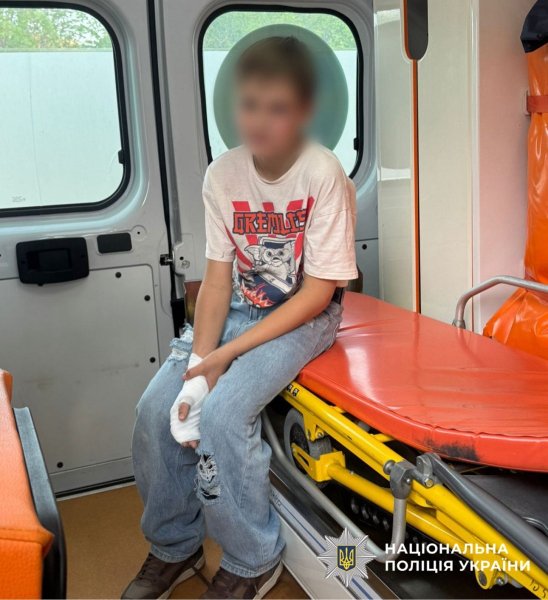 підліток шахед опіки, вибухнула деталь шахеда