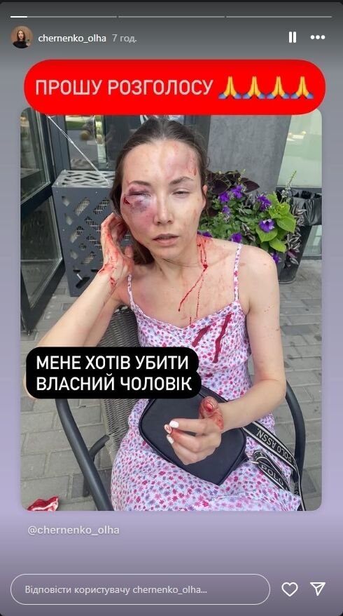 Безжалостно бил ногами: в Киеве мужчина напал на жену у ее квартиры. Подробности и фото