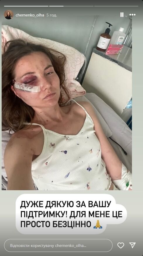 Безжалостно бил ногами: в Киеве мужчина напал на жену у ее квартиры. Подробности и фото