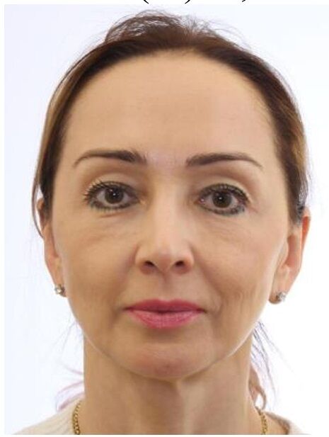 Схема на €30 млн: как фирмы Суботиных вывели средства Минфина и ЕБРР из Мегабанка?