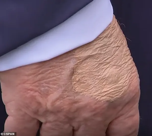 На руке Трампа заметили подозрительный dqxikeidqxiqqeant