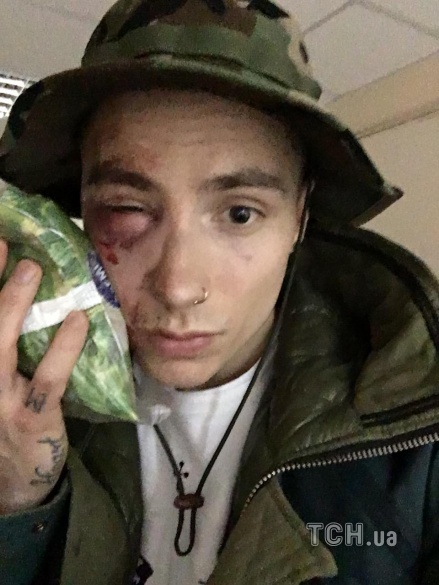 побитий учасник Quest Pistols Show_3 dqxikeidqxiqqeant