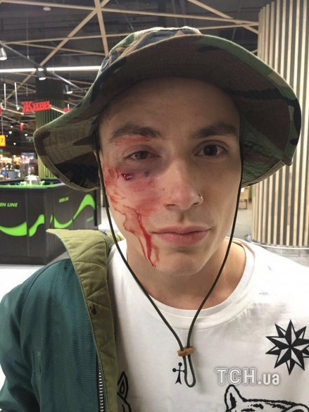 побитий учасник Quest Pistols Show_1