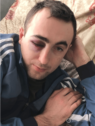 "Я тебя уничтожу!" Подробности избиения ветерана АТО киевским чиновником Василием Лозовым "Я тебя уничтожу!" Подробности избиения ветерана АТО киевским чиновником Василием Лозовым